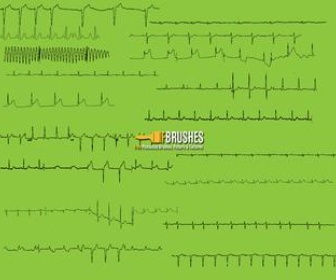 ECG